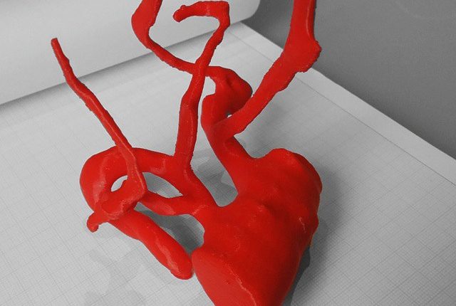 stampa 3D per uso medico e ortodontico